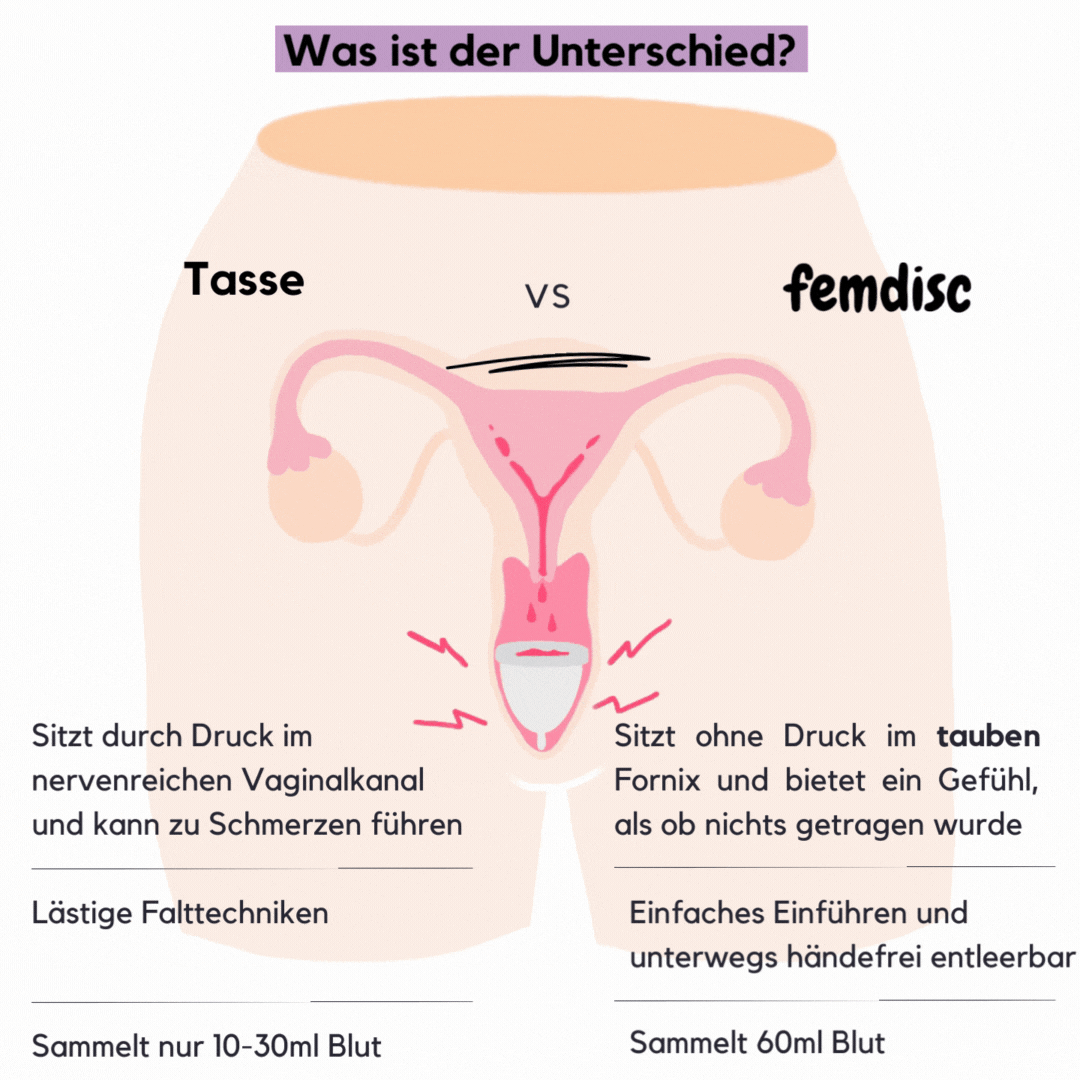 femdisc menstrual disc classic
